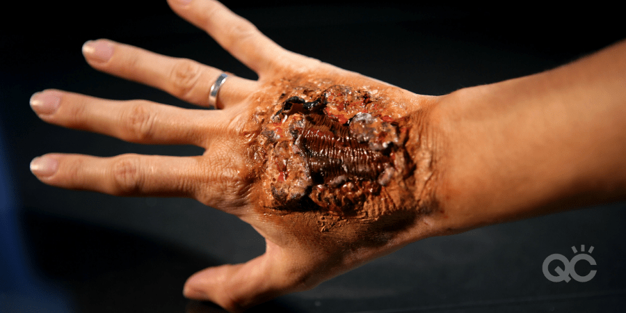 special effects makeup burnt hand prosthetic